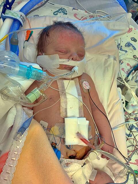 Rinken was less than 2 weeks old when she underwent her first open-heart surgery.
Courtesy photos